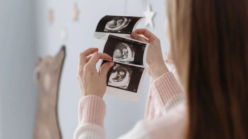Chỉ số độ mờ da gáy có sự thay đổi theo tuần tuổi và chiều dài đầu mông của thai nhi