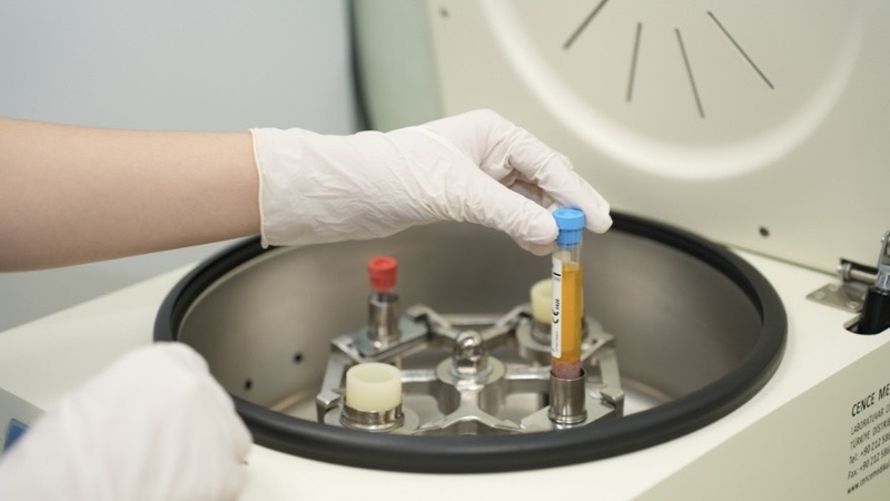 do-do-ngung-tap-tieu-cau-chia-khoa-bao-ve-suc-khoe 3