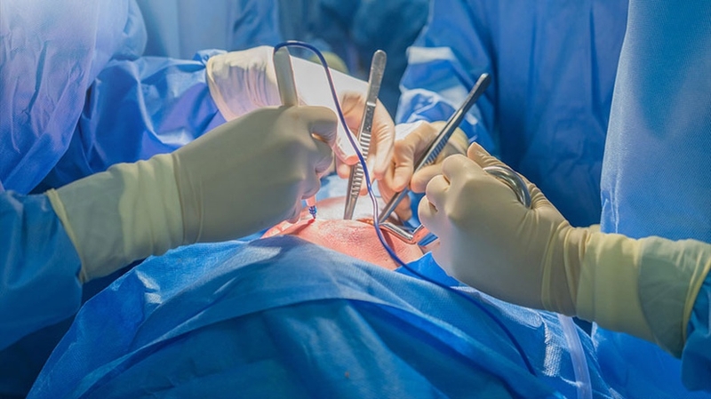 Dò động mạch vành là gì? Triệu chứng của dò động mạch vành 4