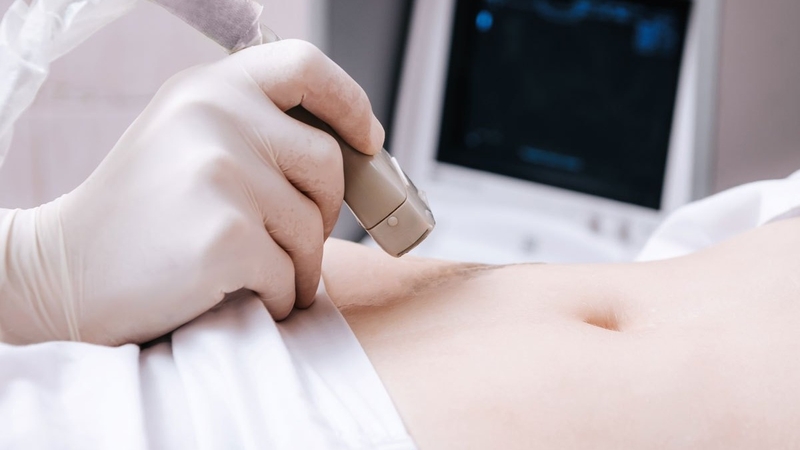 Độ mờ da gáy cao nhưng chọc ối bình thường 1