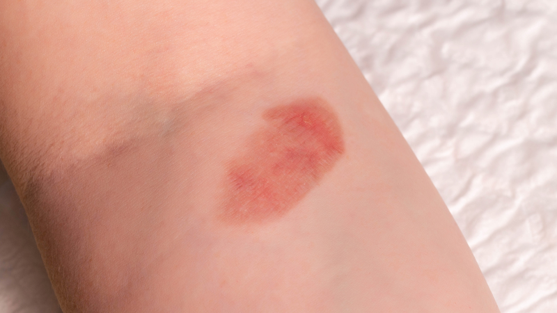 Cây Đỏ ngọn - vị thuốc thanh nhiệt hiệu quả 7