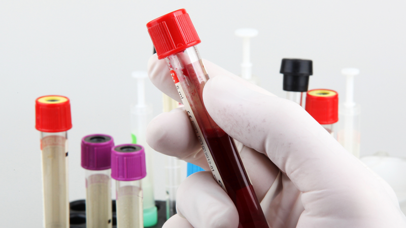 Độ nhạy và độ đặc hiệu: Khái niệm và ứng dụng trong y học 4