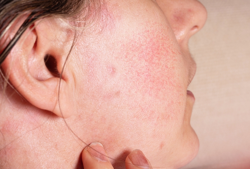 Độ pH của sữa rửa mặt bao nhiêu là tốt nhất? 5