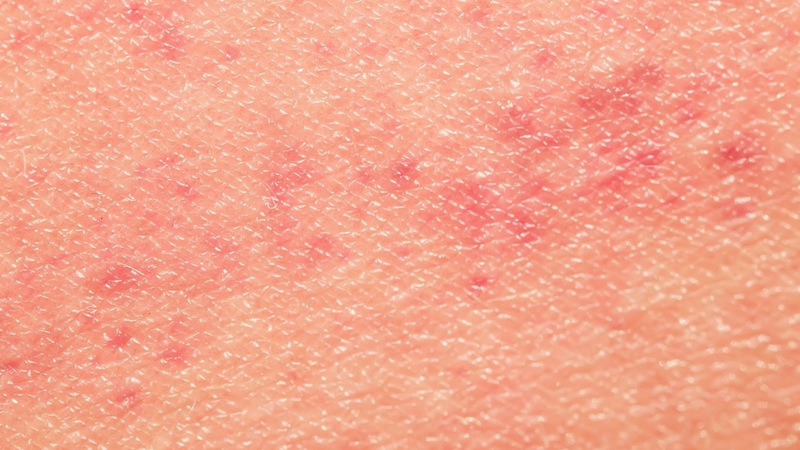 Nước sinh hoạt quá axit hoặc kiềm có thể làm da khô, mất cân bằng, nhạy cảm và dễ bị kích ứng hoặc mụn