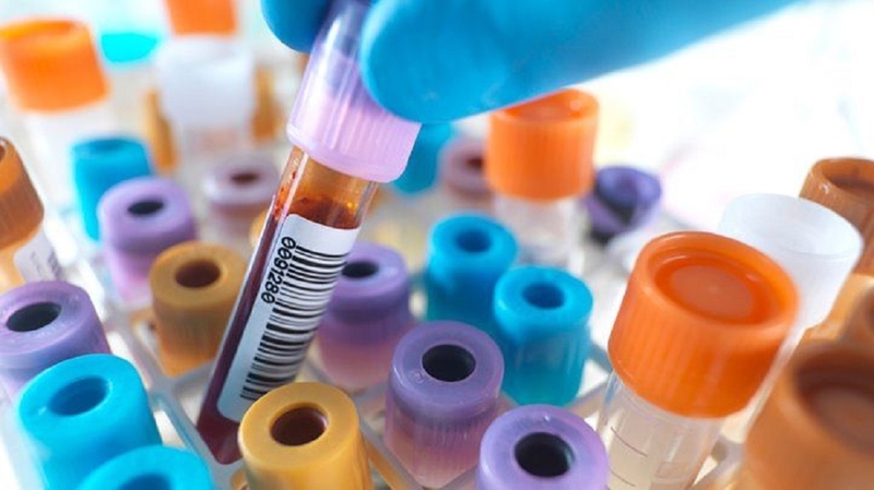 Đo tải lượng virus viêm gan C là gì? Phương pháp đo tải lượng virus viêm gan C 2