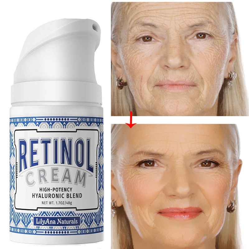 Độ tuổi nào nên dùng kem chống lão hóa và nếp nhăn 2