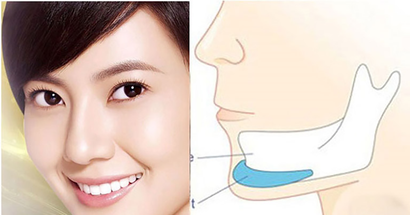 Độn cằm ăn gì mau lành?1