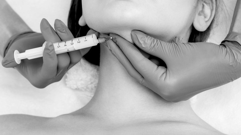 Độn cằm lẹm - cách khắc phục chiếc cằm bị lẹm hiệu quả3