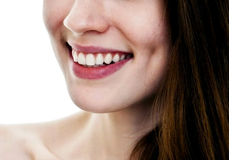 Má lúm đồng điếu ở rãnh cười là một vết lõm nhỏ xuất hiện ở phía dưới, gần sát khóe miệng