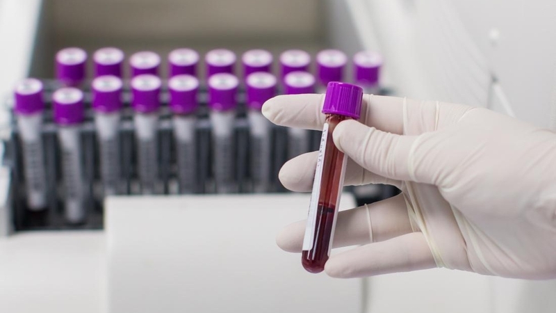 Đông lạnh hồng cầu có tác dụng gì 3