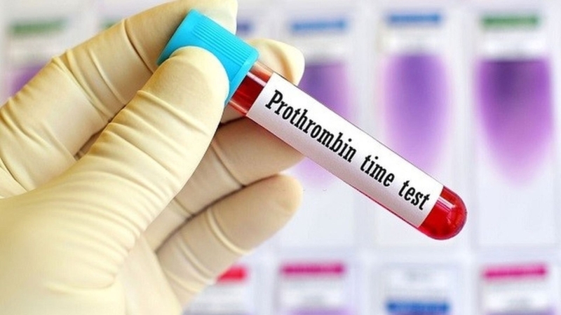 Xét nghiệm PT là một trong các xét nghiệm đánh giá đông máu