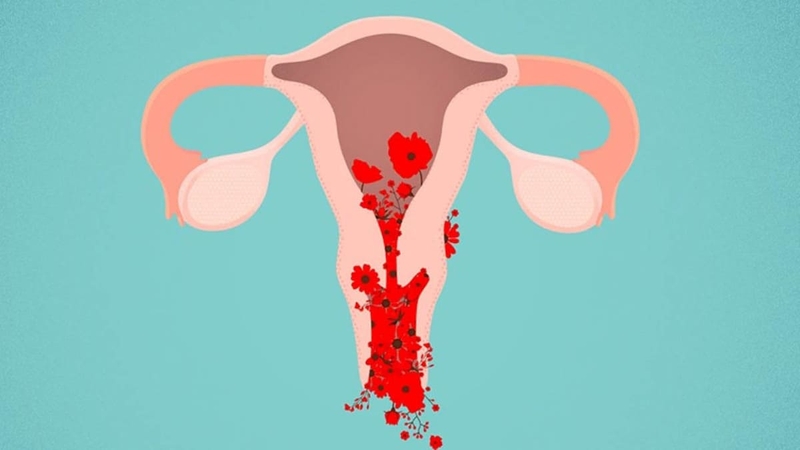 Đông máu rải rác trong lòng mạch là gì? Nguyên nhân và triệu chứng của bệnh 3