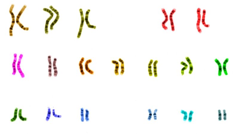 Đột biến cấu trúc nhiễm sắc thể là sự thay đổi tổ chức gen trong một nhiễm sắc thể