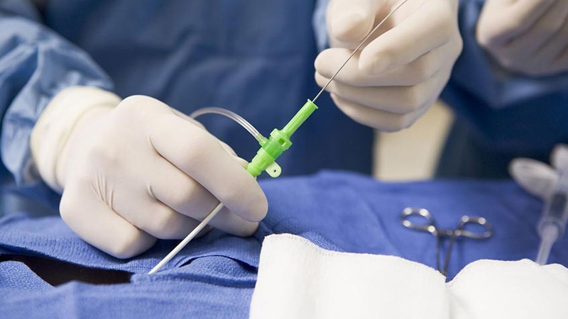 Đốt điện tim là gì? Các rủi ro khi đốt điện tim bạn cần biết 3