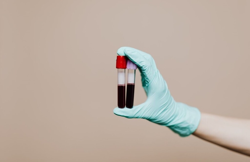 Đột quỵ liệt nửa người: Nguyên nhân, dấu hiệu nhận biết, chẩn đoán và điều trị 3