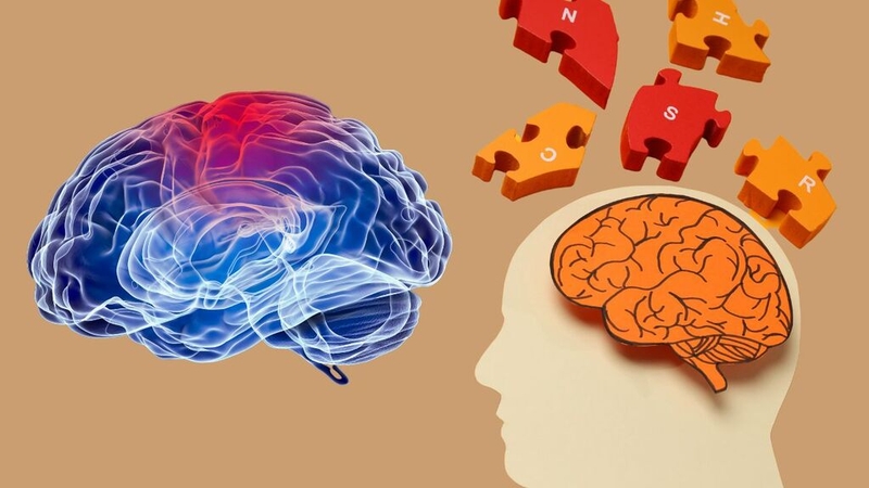 Đột quỵ mất trí nhớ: Nguyên nhân, triệu chứng và phương pháp điều trị 3