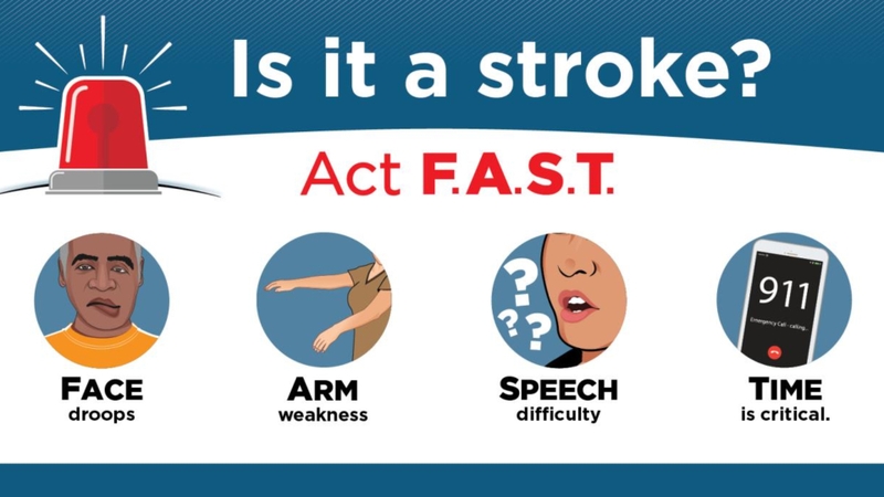 Đột quỵ não: Nguyên nhân, triệu chứng, phương pháp điều trị 4