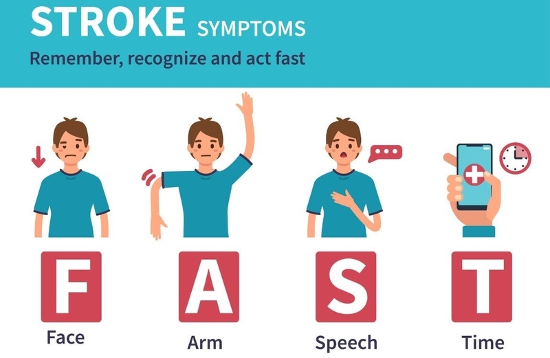 Đột quỵ thiếu máu cục bộ là gì? Những vấn đề cần biết về đột quỵ thiếu máu cục bộ 4