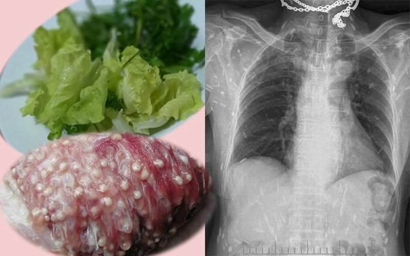 Ăn tiết canh bị tiêu chảy và mắc bệnh đường ruột?-3