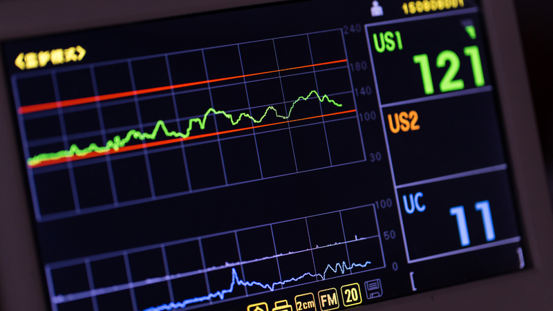 Dự đoán tuổi ECG do AI điều khiển giúp phát hiện bệnh sớm 2