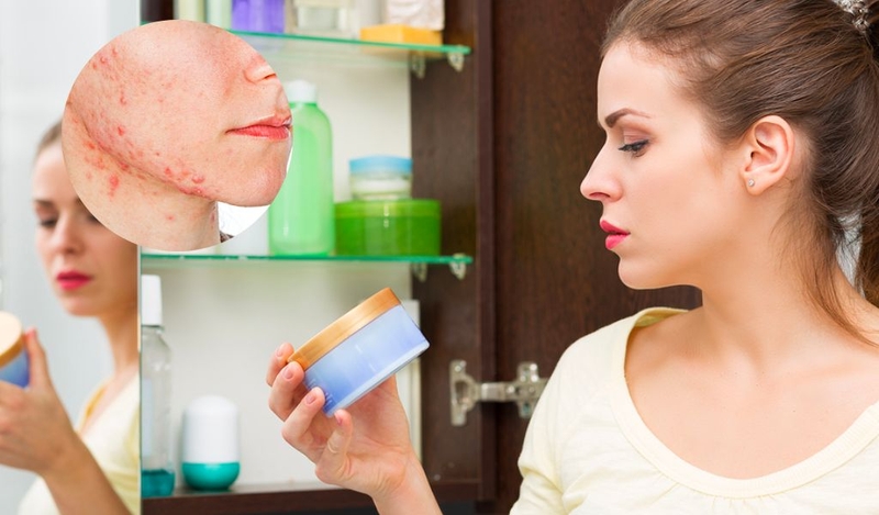 Những sai lầm cần tránh khi bị dị ứng mỹ phẩm nổi mụn 1