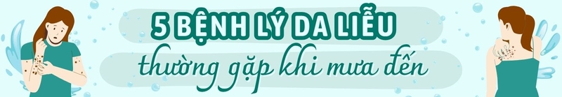 Đừng để da “kêu cứu” mùa mưa: 5 bệnh ngoài da cần tránh ngay 1