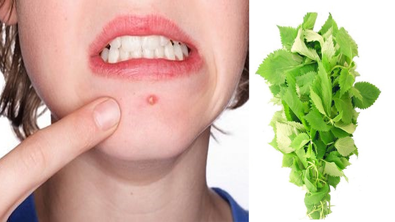 Dùng lá kinh giới chữa mụn nhọt có hiệu quả không? 2