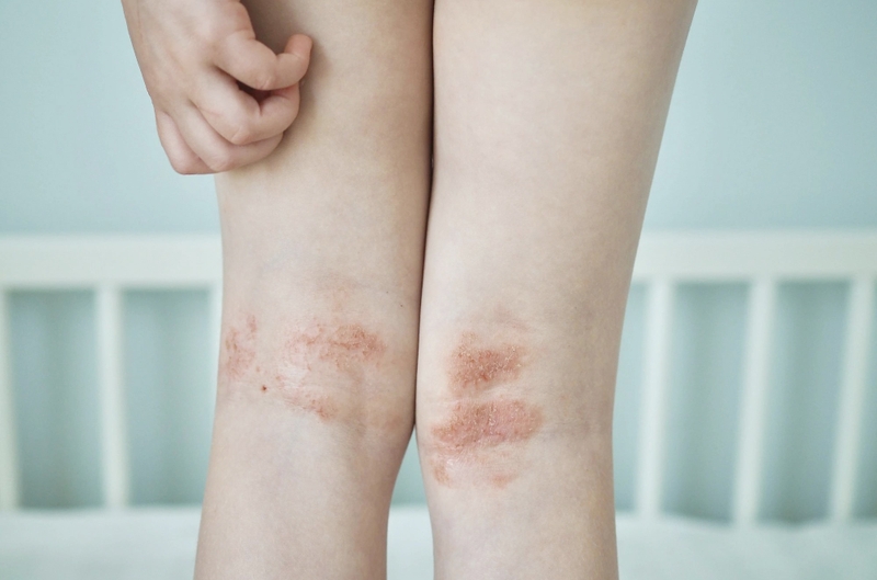 Dùng quá liều vitamin gây ra những ảnh hưởng gì với sức khỏe? - 4