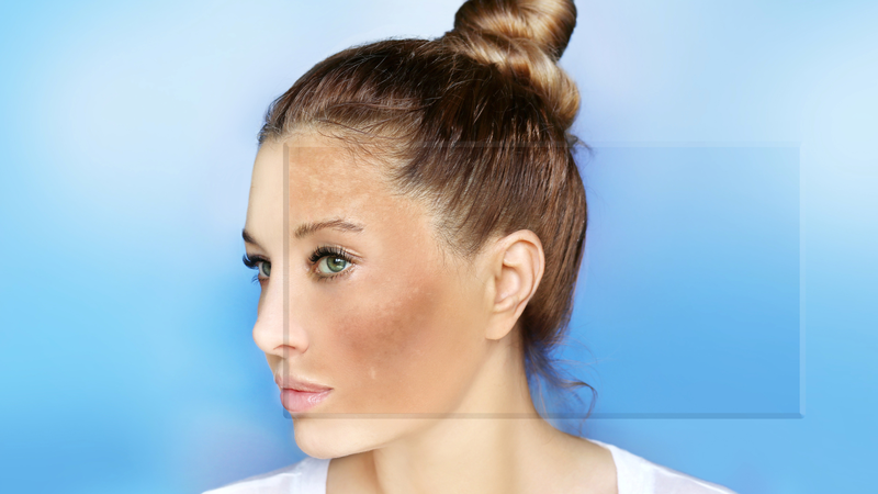 Sử dụng retinol đều đặn và đúng cách giúp ngăn ngừa sự hình thành nám