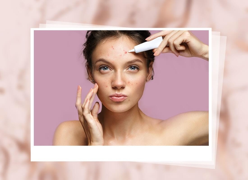 Dùng serum bị nổi mụn có thể do bạn đã sử dụng sản phẩm chất lượng kém