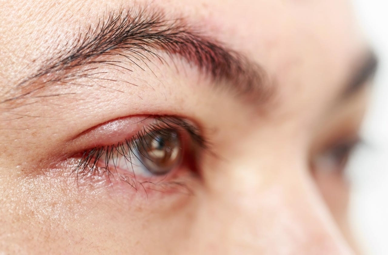 Dùng thuốc nhỏ mắt trị đau mắt hột có chữa được bệnh 2