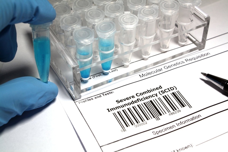 Dùng virus HIV chữa bệnh cho những 'em bé bong bóng' 1