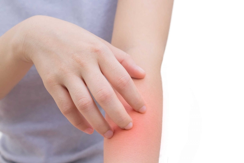 Đừng xem thường khi có dấu hiệu nốt thủy đậu nhiễm trùng 2