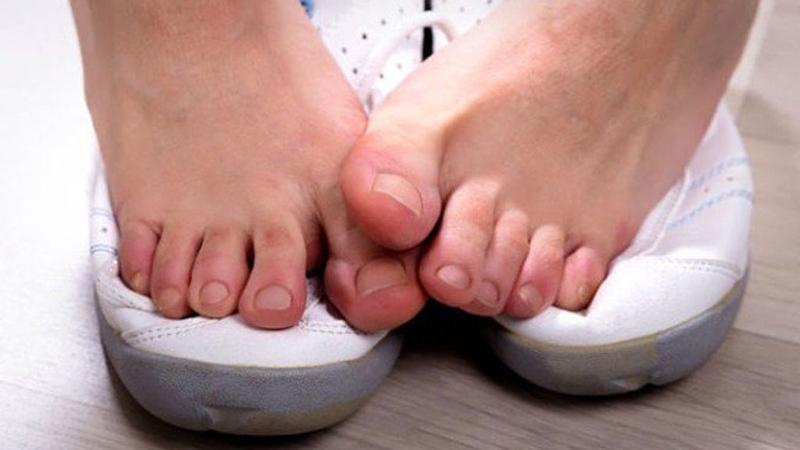 Dùng xịt khử mùi Etiaxil Deodorant Anti-Transpirant Protection: Cách khử mùi hôi chân hiệu quả! 1