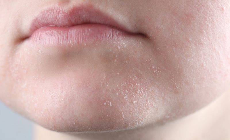 Dưỡng da khô bằng dầu dừa thế nào cho hiệu quả 3