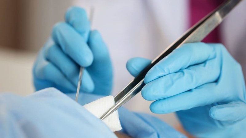 Đứt cơ thắt hậu môn là gì? Cách điều trị như thế nào? 4