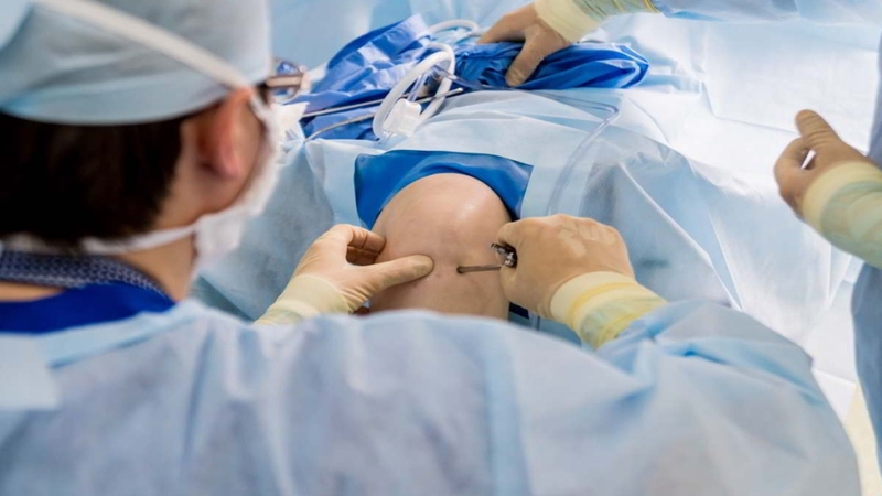 Đứt dây chằng đầu gối có phải mổ không? Những điều bạn cần biết 3