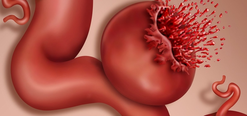 dut-dong-mach-chu-rat-hiem-nhung-rat-hiem 1.jpg