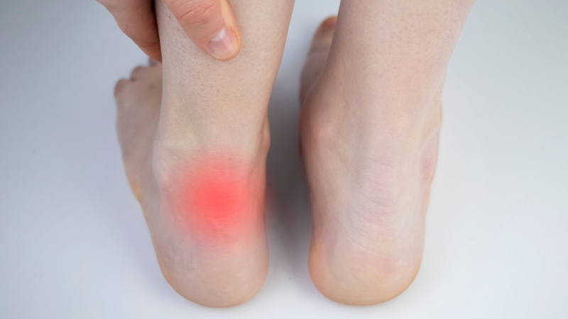 Đứt gân gót chân là gì?