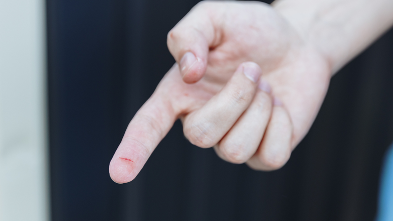 Nếu máu chảy kéo dài hoặc khó kiểm soát, đây có thể là dấu hiệu cảnh báo những vấn đề bất thường