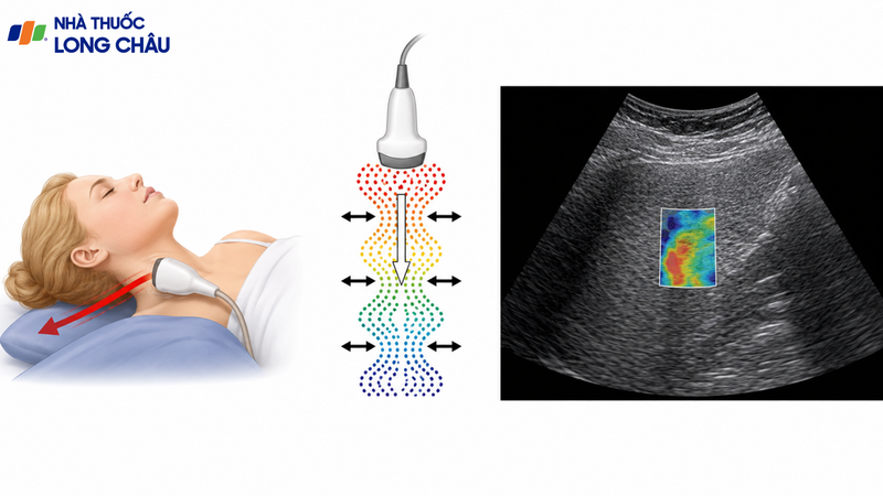 Elastography giúp đánh giá độ cứng và độ đàn hồi của mô trong cơ thể