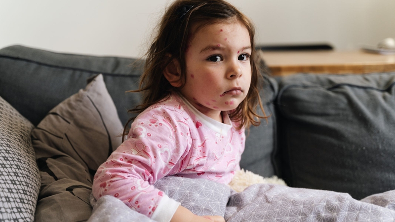 Enterovirus là gì? Triệu chứng và cách phòng ngừa hiệu quả 3