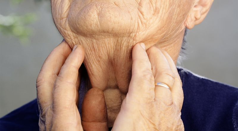 Eo tuyến giáp là gì Đóng vai trò gì đối với sức khỏe con người 2