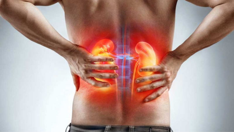 ESRD là gì? Biến chứng của ESRD là gì? 3