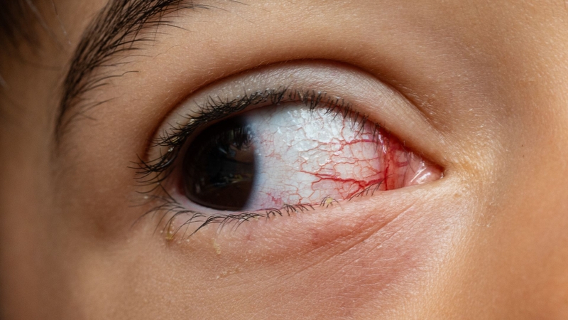 Cần nhiều thử nghiệm lâm sàng trên người để xác nhận hiệu quả rõ ràng