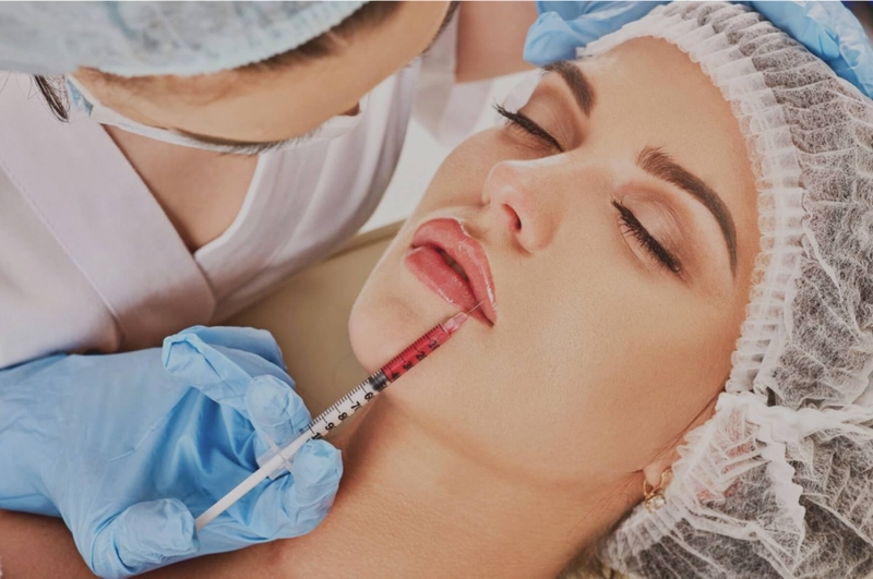 Filler Celosome là gì? 4 loại filler được sử dụng trên thế giới 3