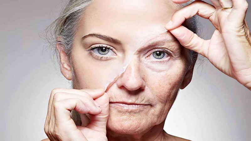 Filler Dermalax: Giải pháp xóa mờ nếp nhăn 4