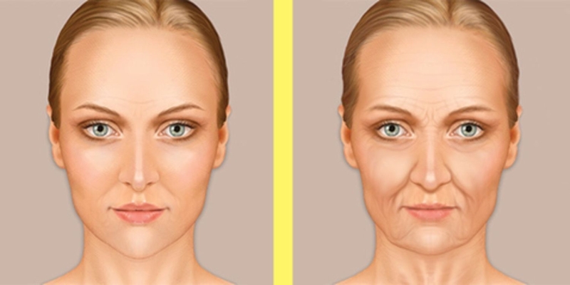 Filler Dermalax: Giải pháp xóa mờ nếp nhăn 5