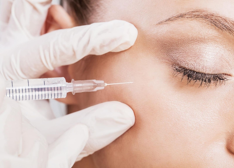 Filler là gì Những điều cần biết khi làm đẹp bằng filler 2