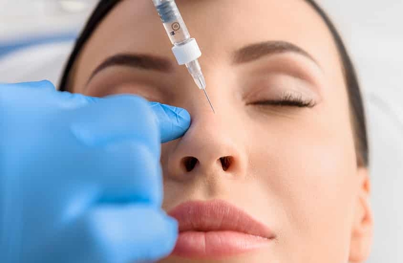 Filler là gì? Những điều nhất định phải biết trước và sau tiêm filler 6